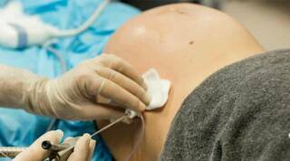 Defender la vida: Cirugía en el vientre materno salva a bebés que presentan una condición potencialmente fatal